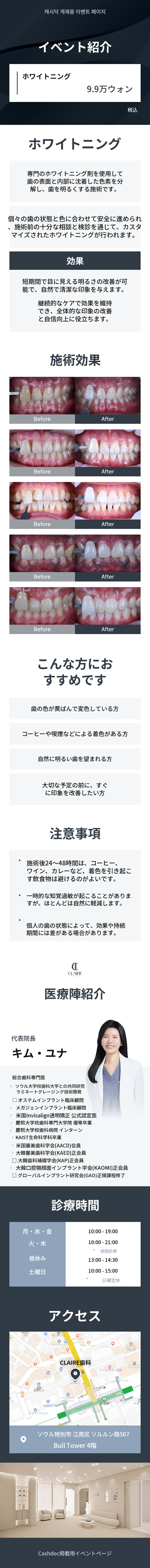 クレア歯のホワイトニング