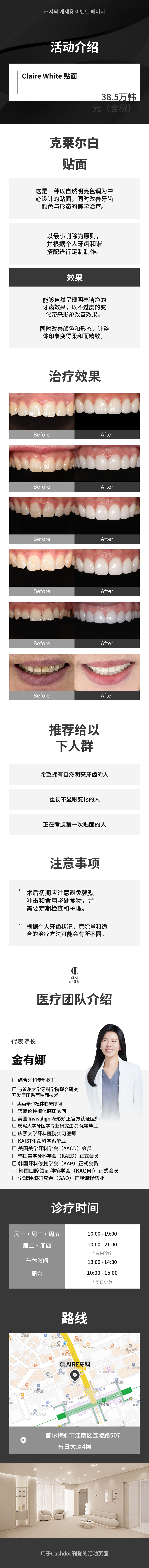 克莱尔白色贴面