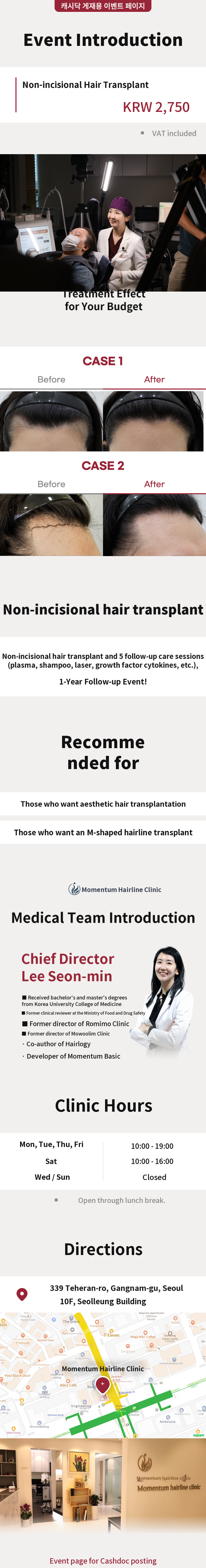 Momentum Non-invasive Hair Transplant Event