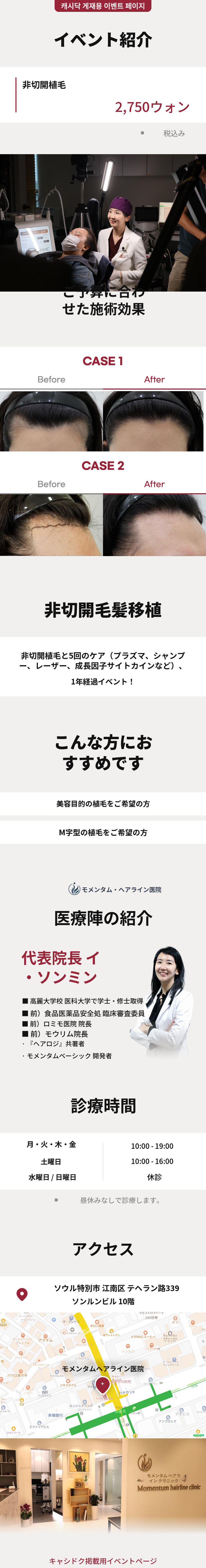 モメンタム非切開毛髪移植イベント