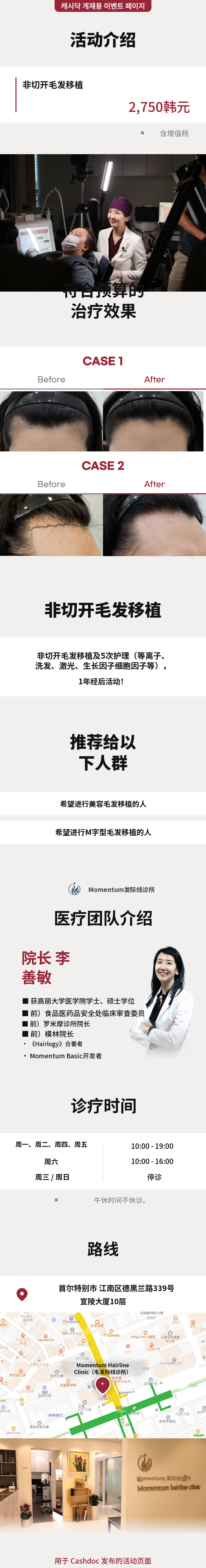 动量无切口植发活动