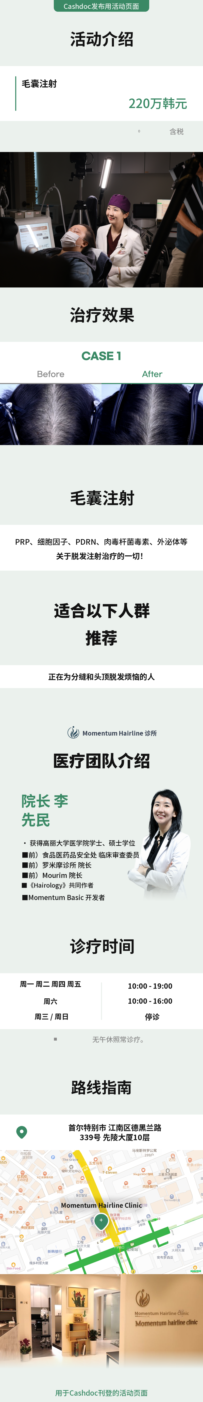 动量毛囊注射活动