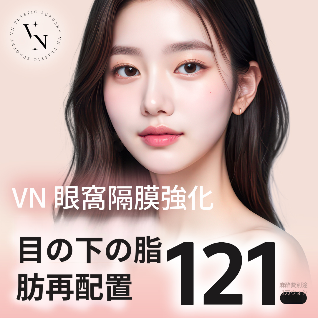 Vn目の下脂肪再配置