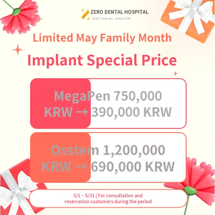 Implant Discount Event in May 2026