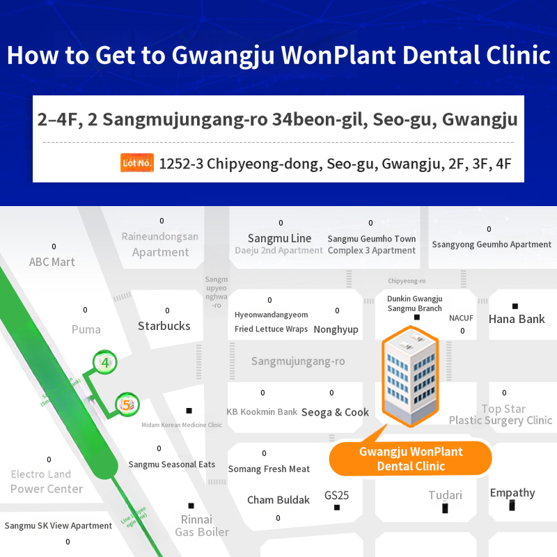 Gwangju Implant 590,000 won → 390,000 won