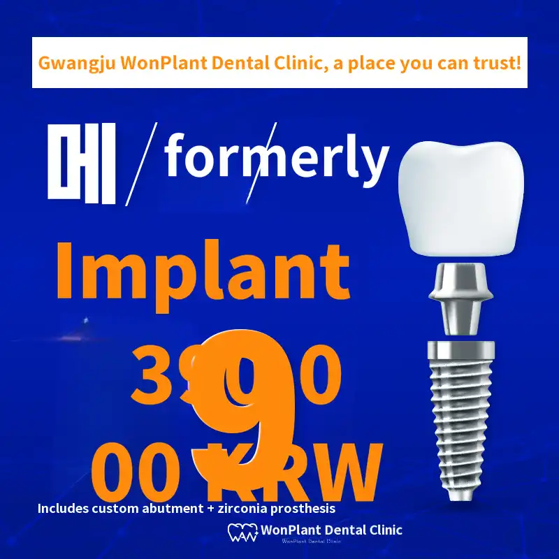 Gwangju Implant 590,000 won → 390,000 won