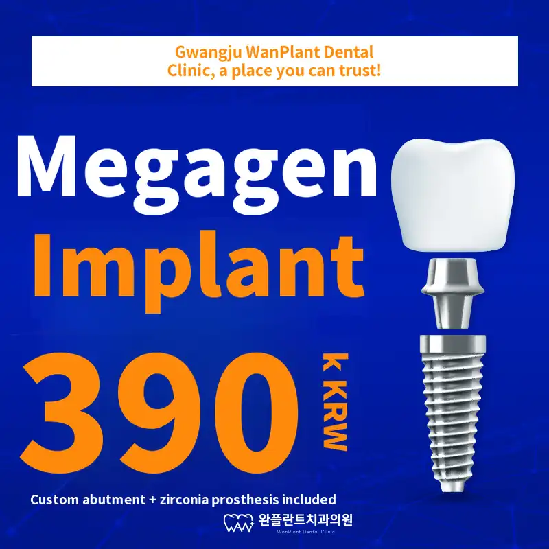 Gwangju Dental Implants: 590,000 won → 390,000 won