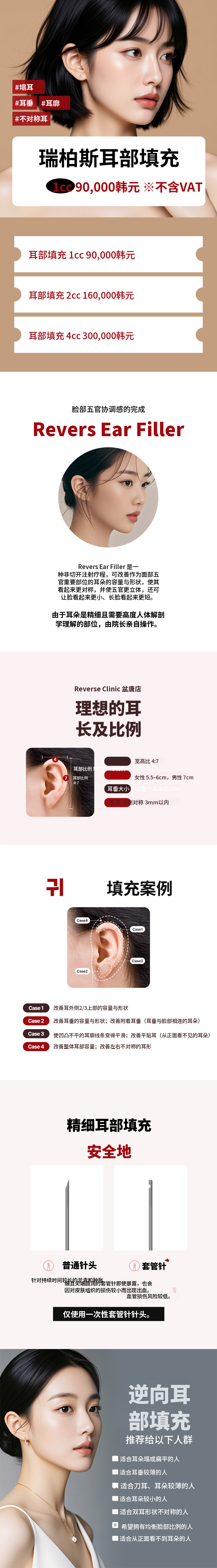 盆唐耳填充剂 - 躺耳、耳垂、耳廓、非对称耳