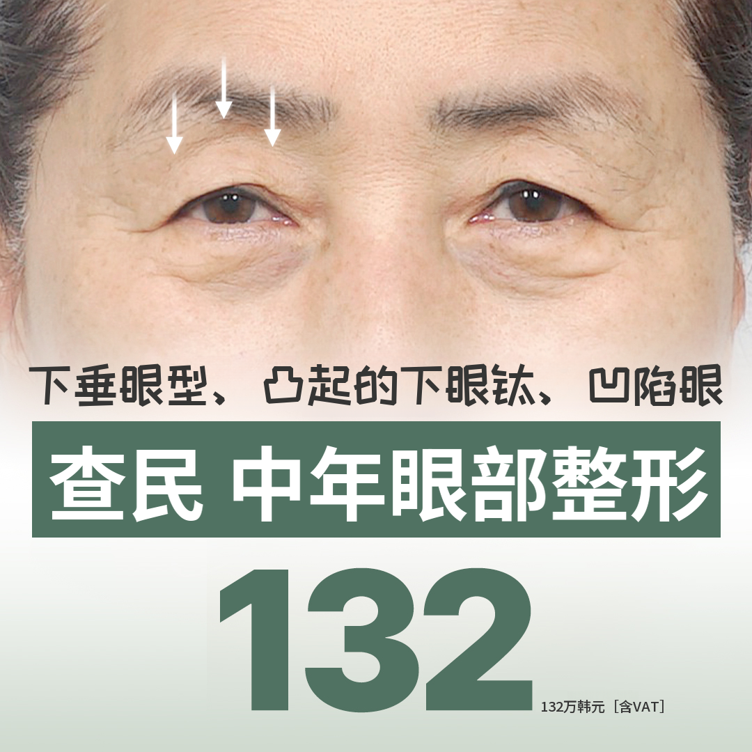 车敏中年眼部整形