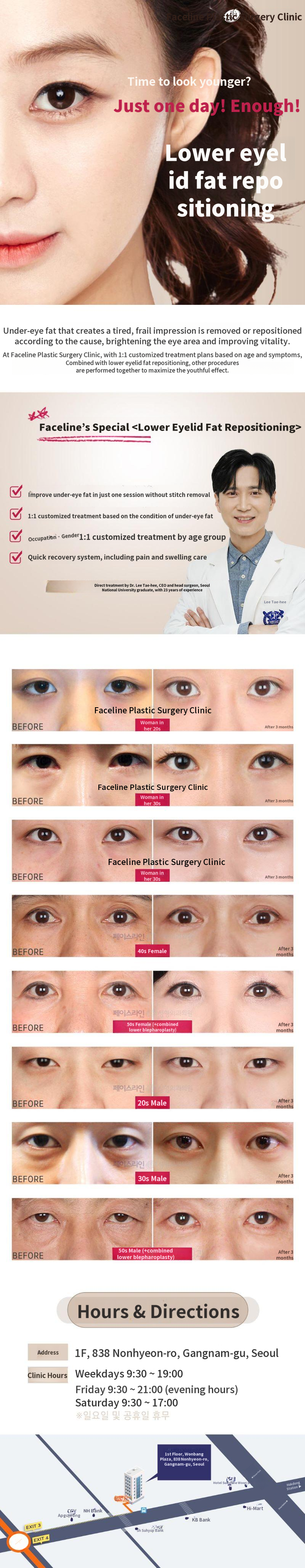 Lower Eyelid Fat Repositioning