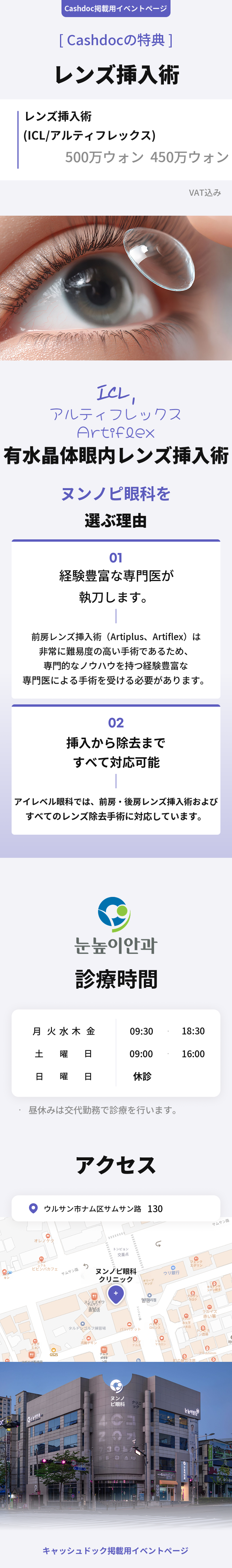 ICL手術（ICL／アルティフレックス）