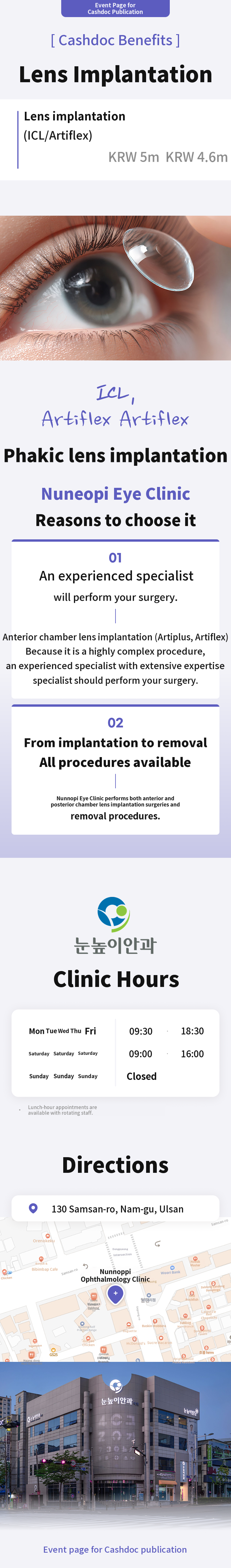 ICL Surgery (ICL/Artiflex)