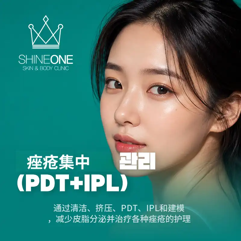 痤疮集中管理（PDT+IPL）