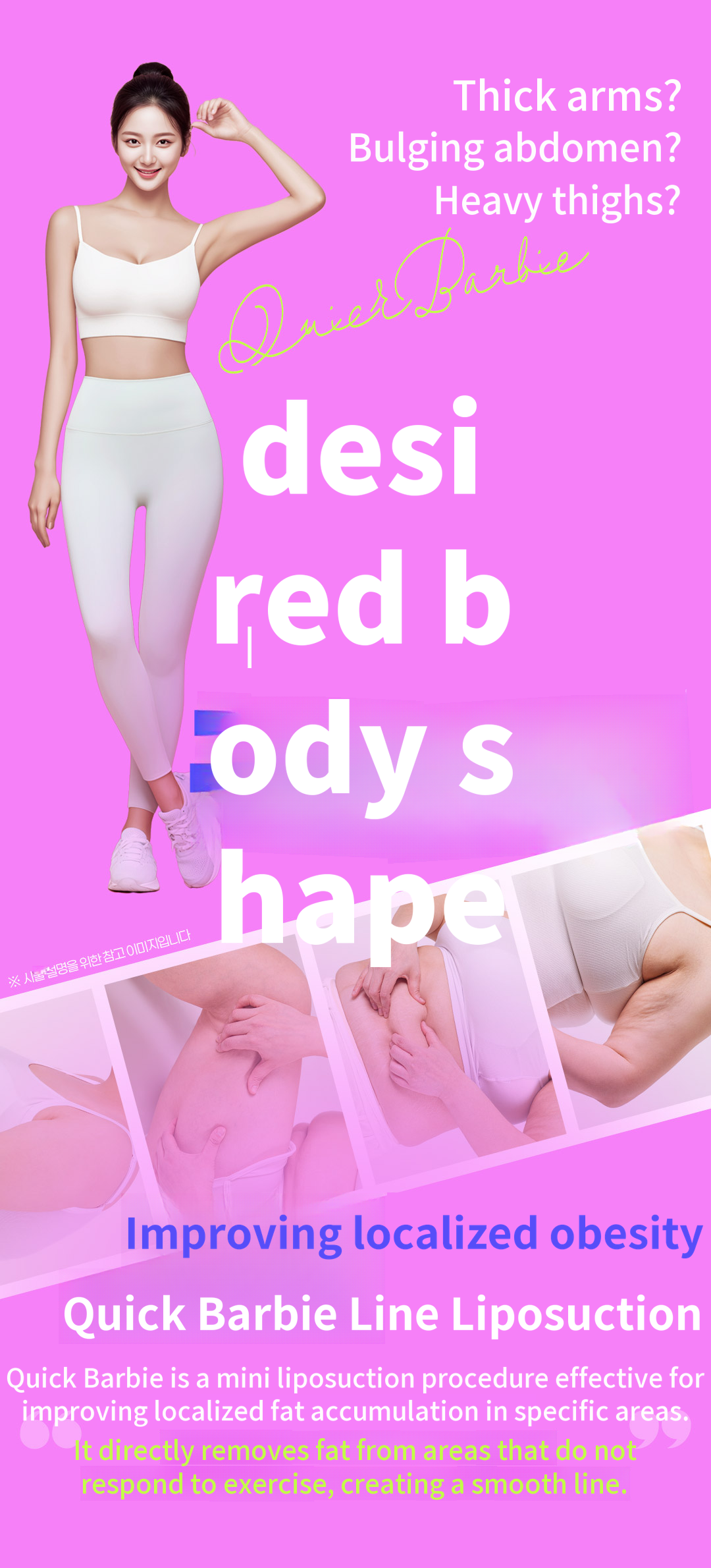 Large area liposuction, no compression garments needed, able to return to work the next day
