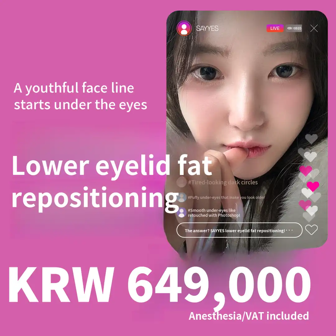 Dark circles, effective treatment for under-eye fat - Under-eye fat repositioning event