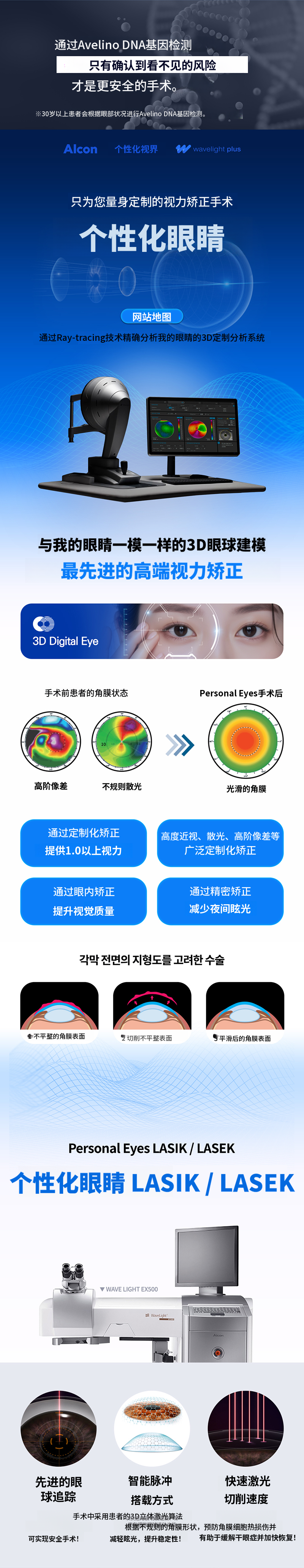 个性化激光矫正手术