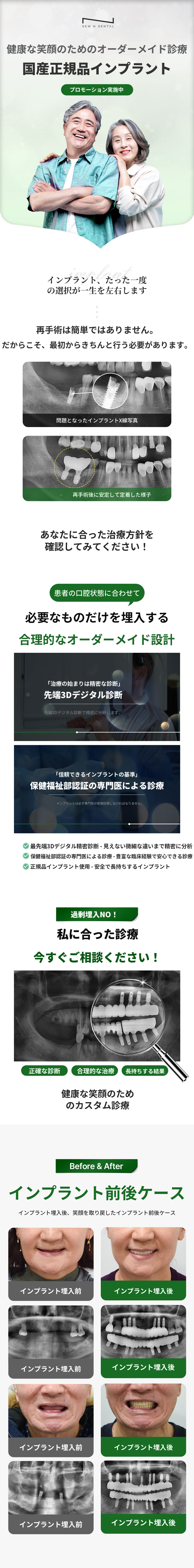 国産正規インプラント 29万円！
