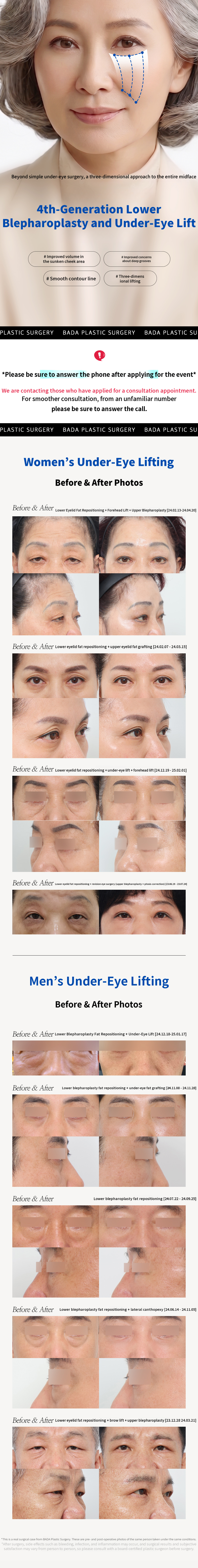 Smooth out bulging and dark under-eye areas with lower eyelid fat repositioning