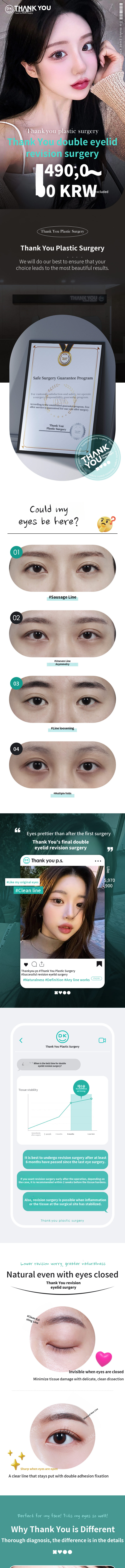 Thank You Eye Surgery