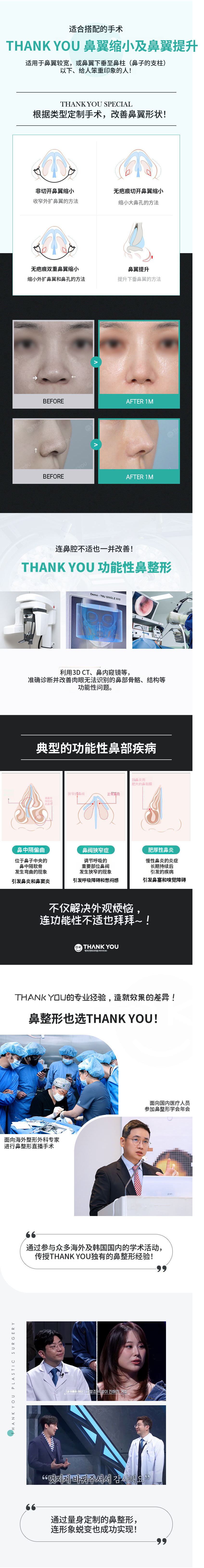 感谢首次鼻整形