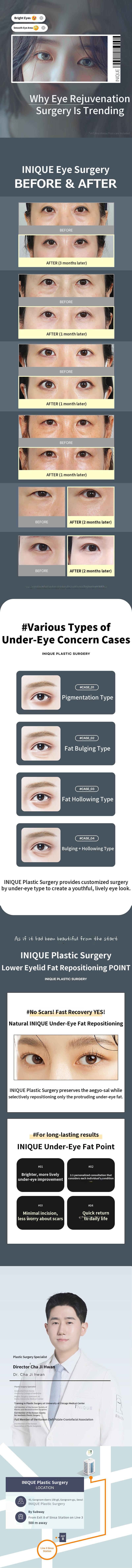 Ainique Under-Eye Fat Transfer
