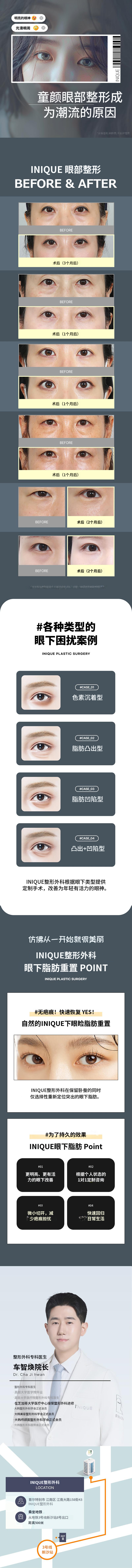 艾妮克眼下脂肪重新分布