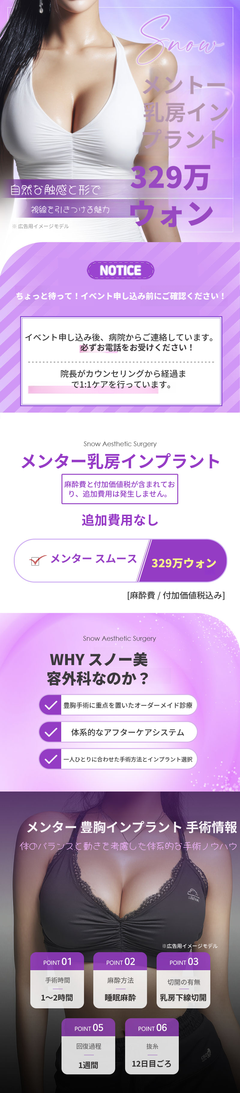 メント胸インプラント