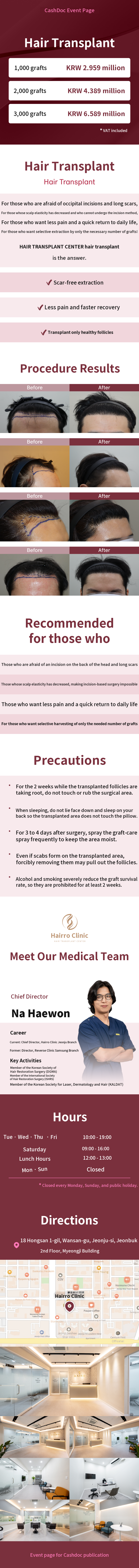 Non-surgical Hair Transplant