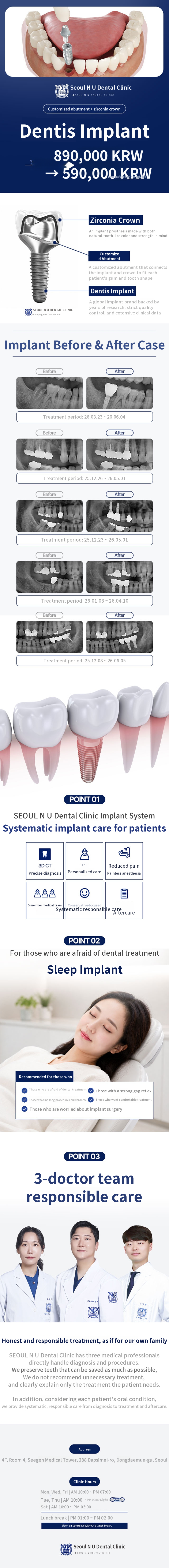 Genuine Dentis Implant Event - 590,000 KRW - Specialist Consultation