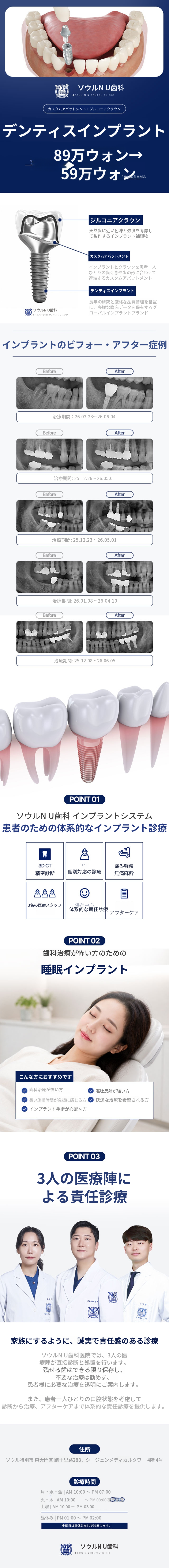正規品デンティスインプラント 59万円イベント - 専門医の診療