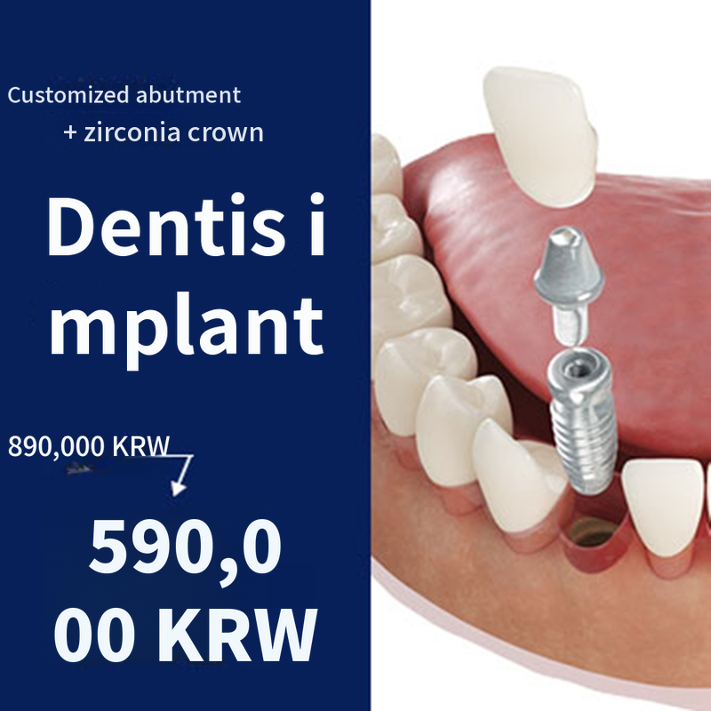 Genuine Dentis Implant Event - 590,000 KRW - Specialist Consultation