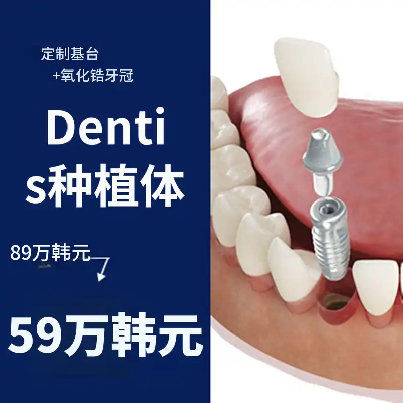 正品德恩蒂斯植牙59万韩元促销 - 专科医生诊疗