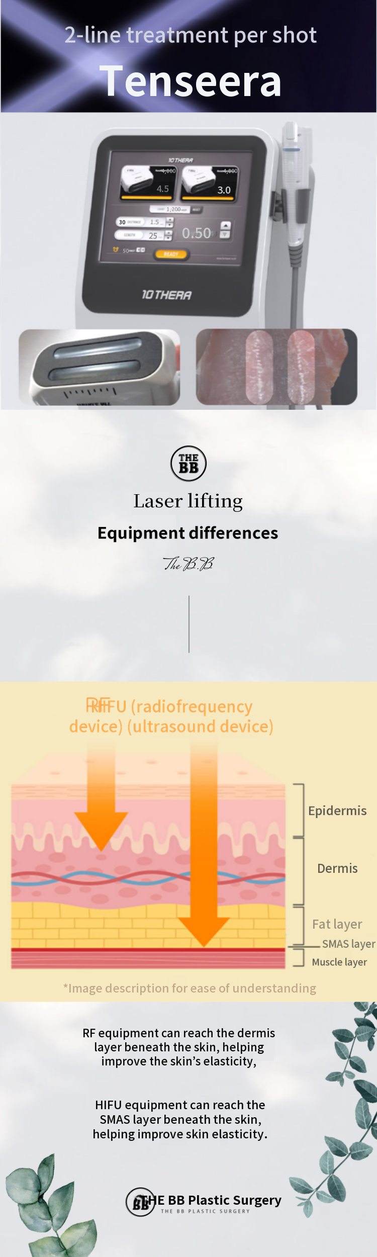 Ultrasound Lifting Tensera
