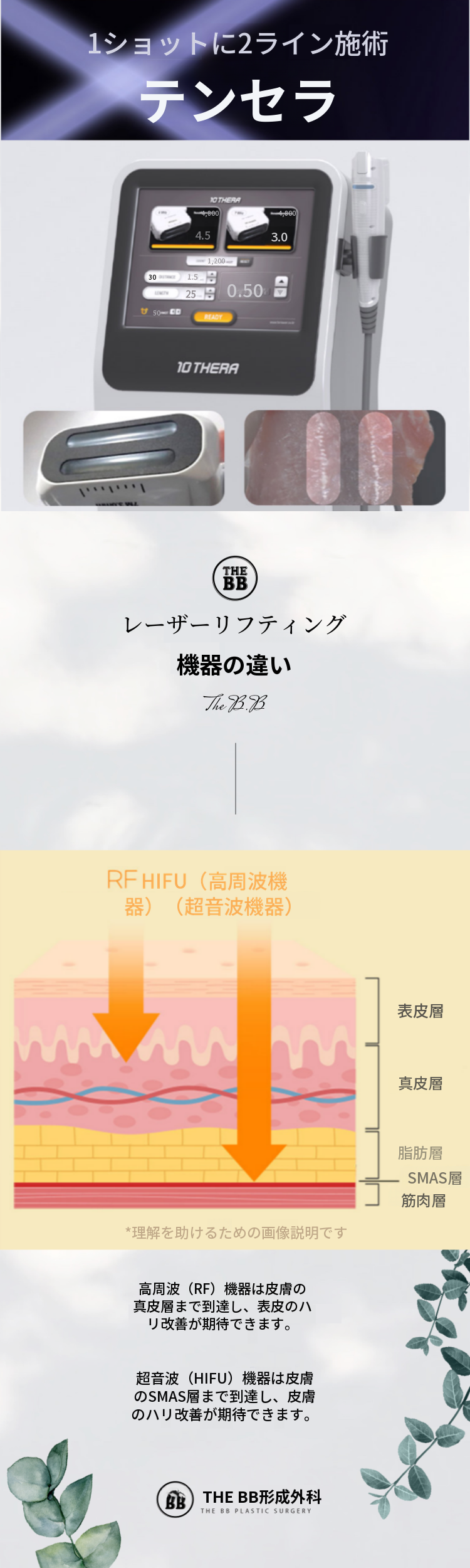 超音波リフティングテンセラ