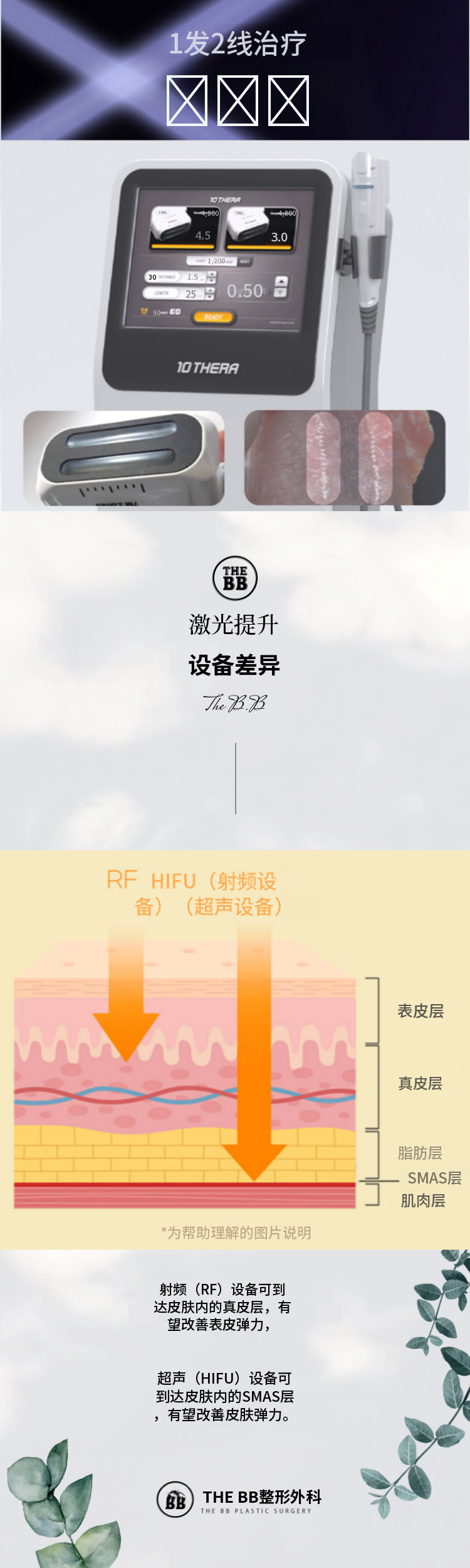 超声波提升 TENSERA