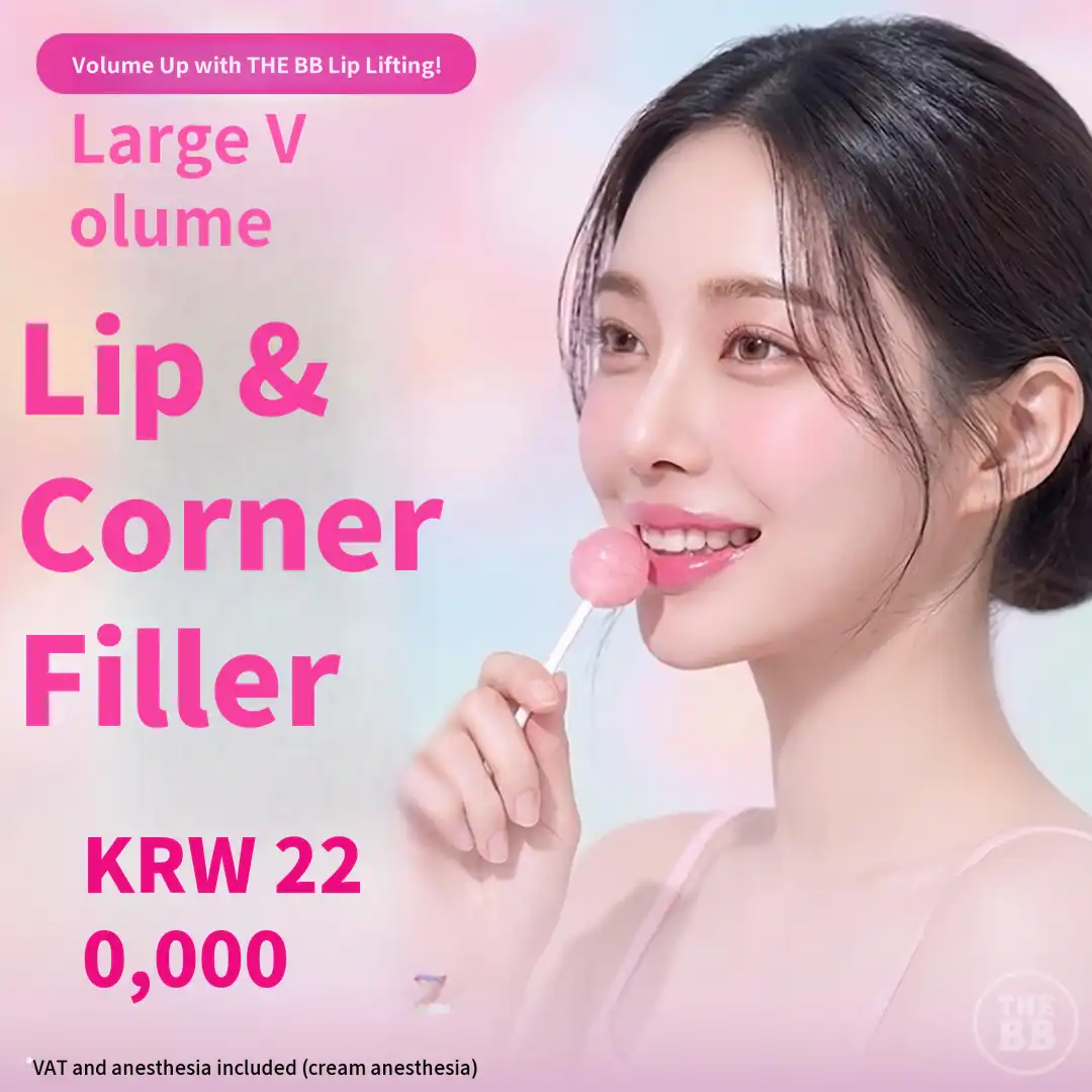 Lip corner filler Botox