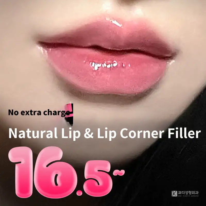 ♡Restylane♡ Lip Volume Filler