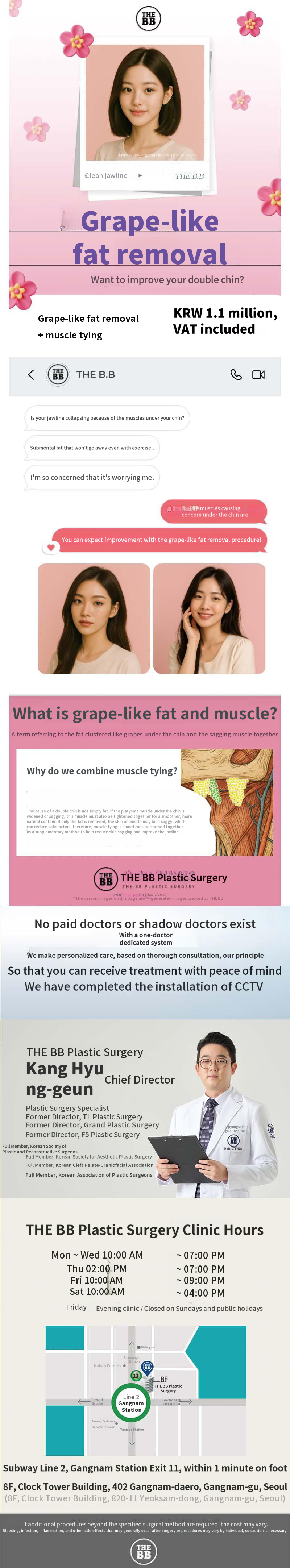 Double Chin Liposuction + Muscle Tightening