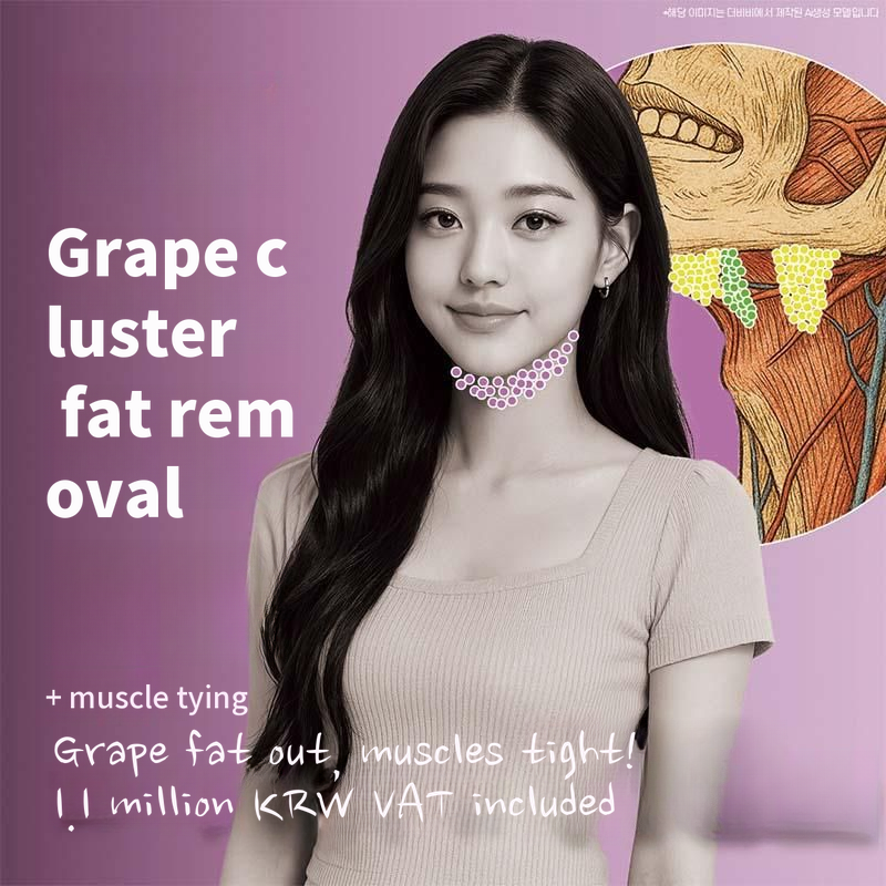 Double Chin Liposuction + Muscle Tightening