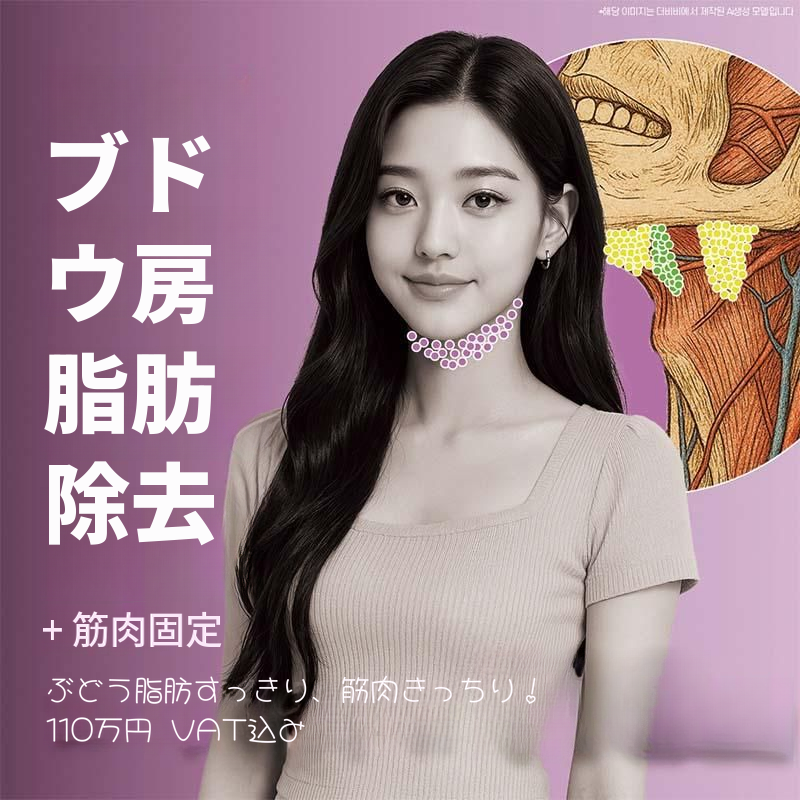 ダブルチン脂肪吸引+筋肉固定