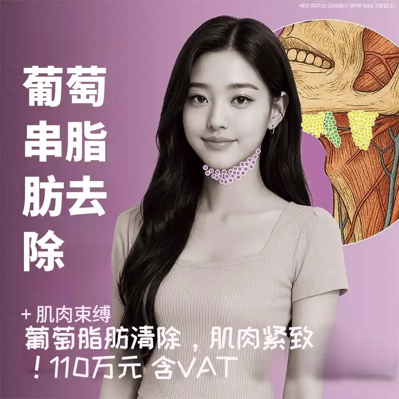 德比比整形外科医院 双下巴脂肪抽吸+肌肉绑扎 项目图片