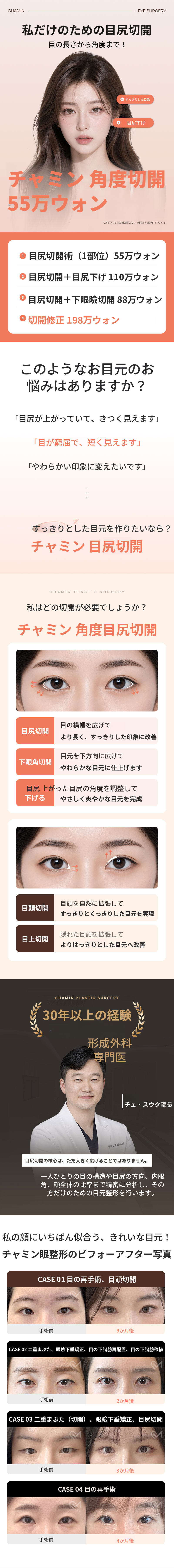 チョ・ミン 角度切開