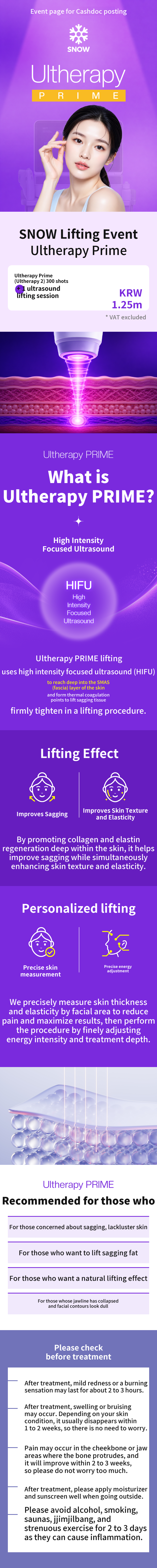 Ultherapy Prime 300 Shots