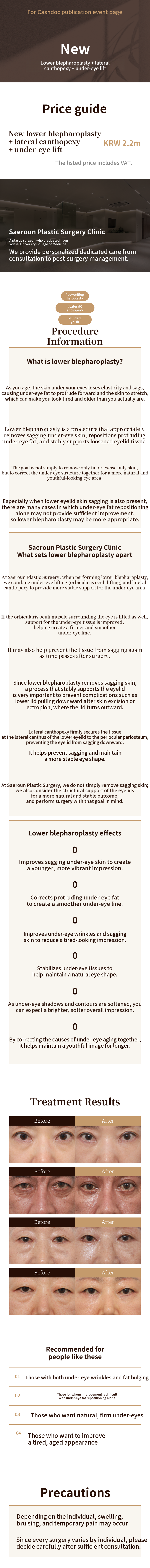 [New] Lower Eyelid Surgery + Lateral Canthopexy + Sub-Brow Lift