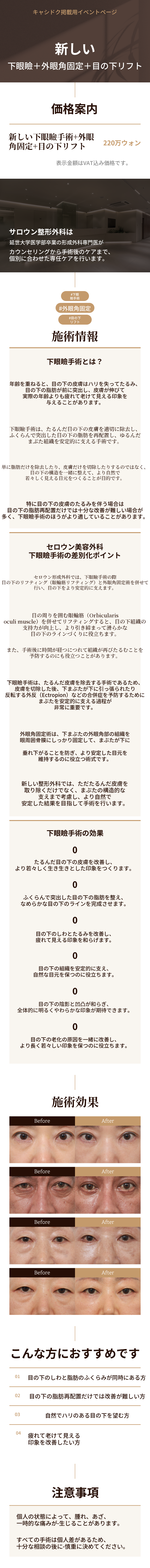 [新しい] 下瞼整形+外眼角固定+目の下リフト