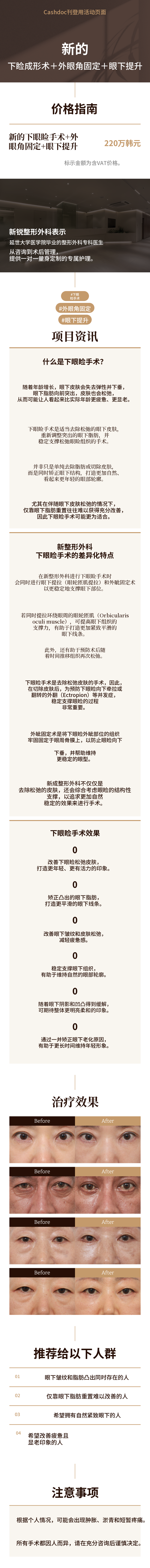 [新] 下眼睑+外眼角固定+眼下提升