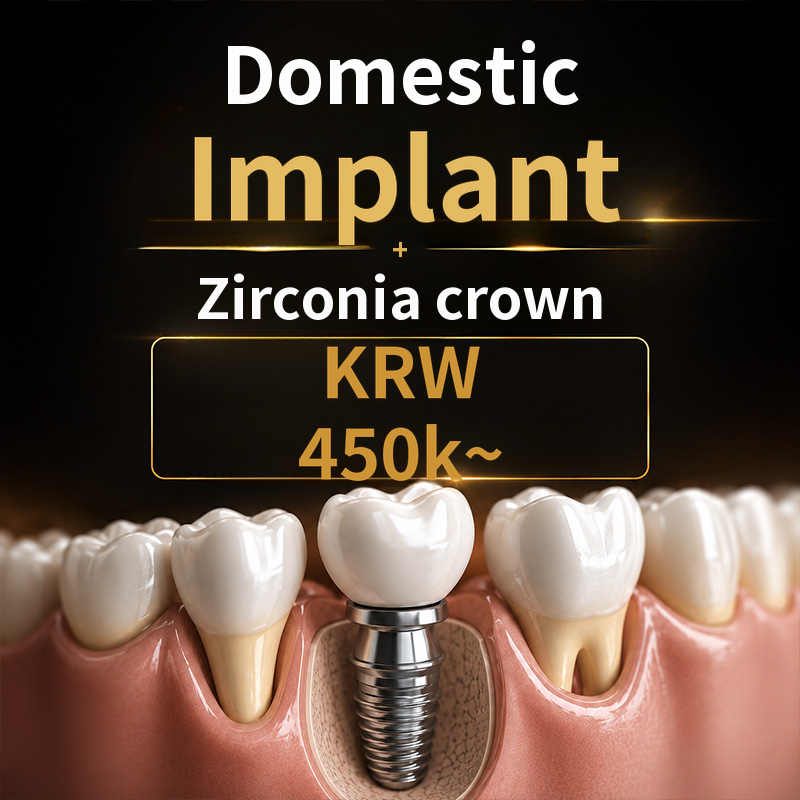Advanced Implant Treatment with Implant + Prosthesis Included