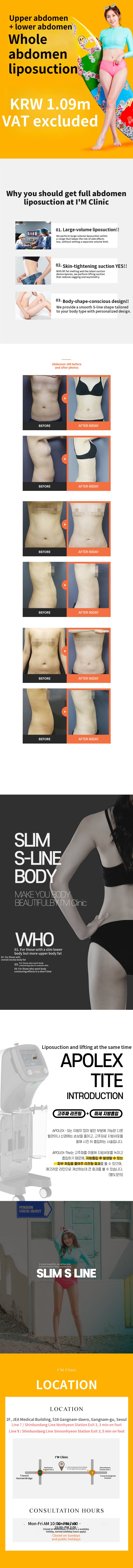 Abdominal Liposuction