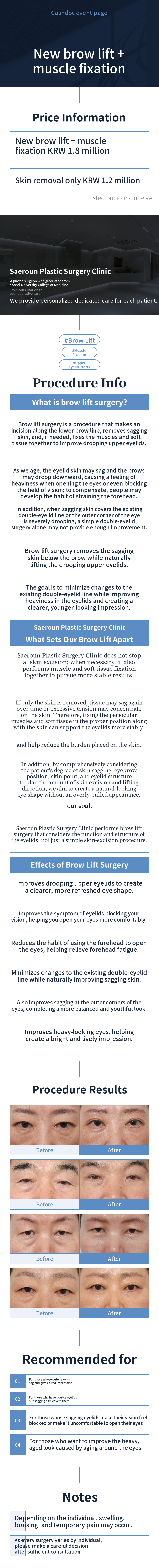 [New] Eyebrow Lifting + Muscle Fixation