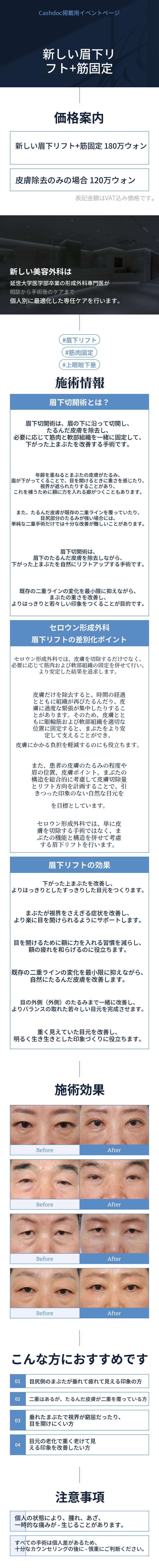 [新しい] 眉下リフト + 筋肉固定